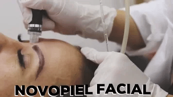 Limpiador Facial Removedor de Puntos Negros con Succión Profunda