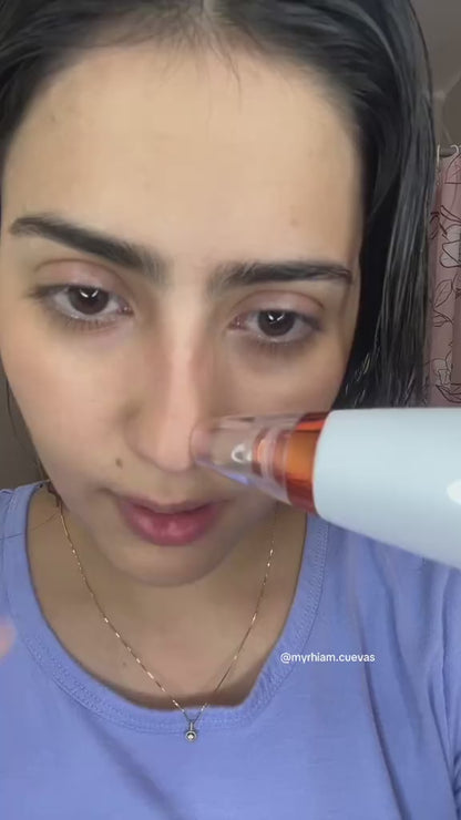 Limpiador Facial Removedor de Puntos Negros con Succión Profunda